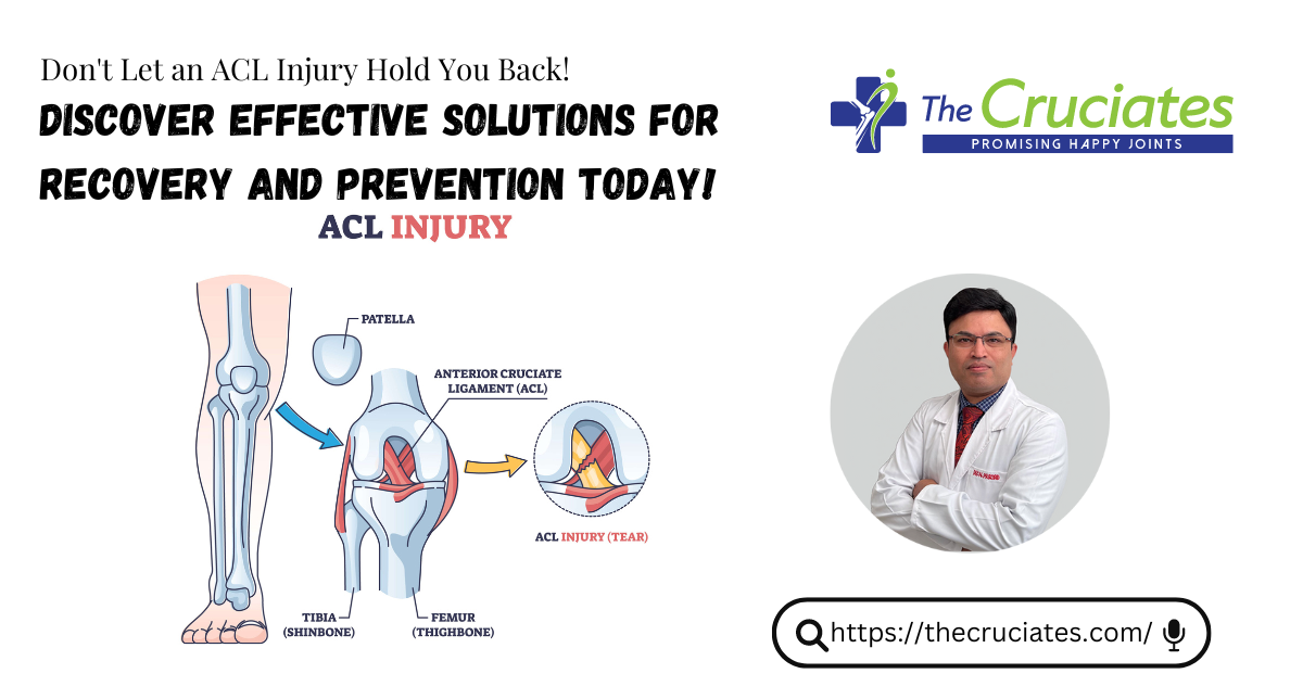 best acl surgeon in gurgaon