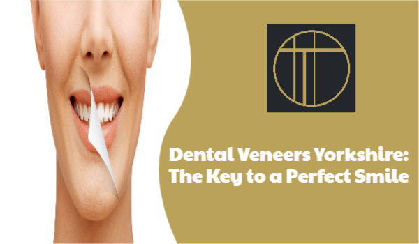 dental Veneers yorkshire