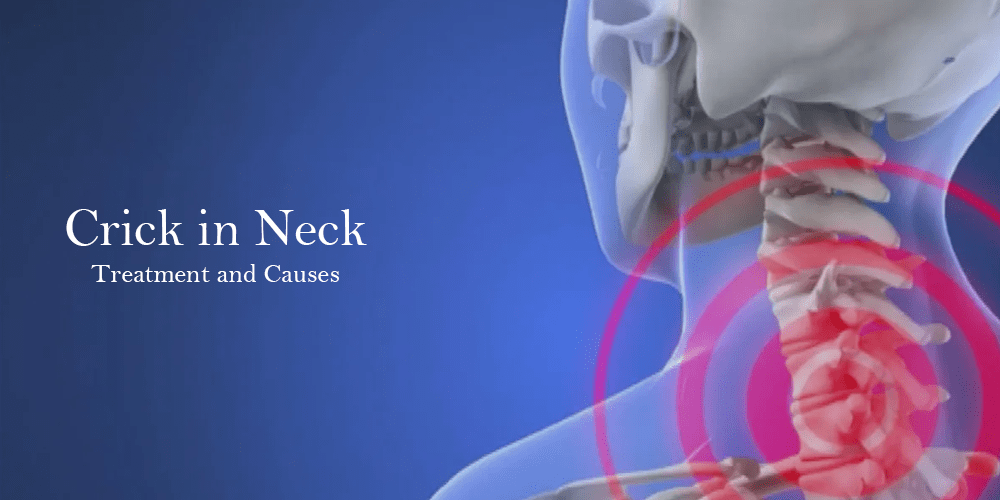 crick-in-neck